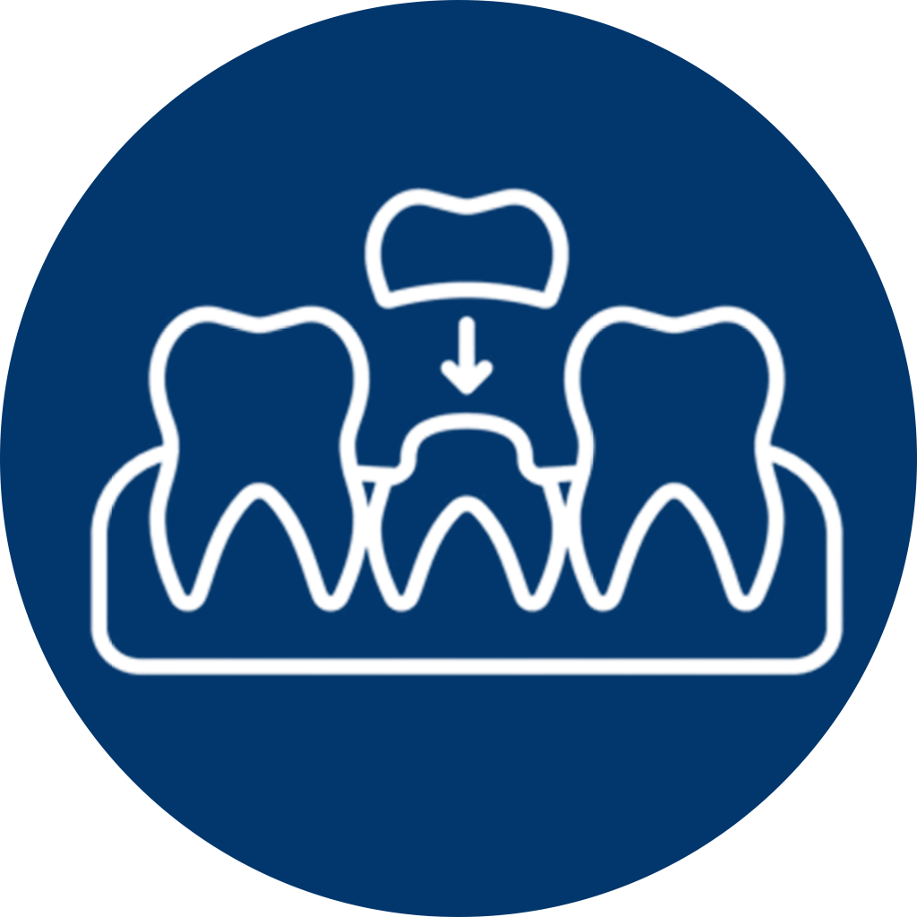 Veneers Fundamentals